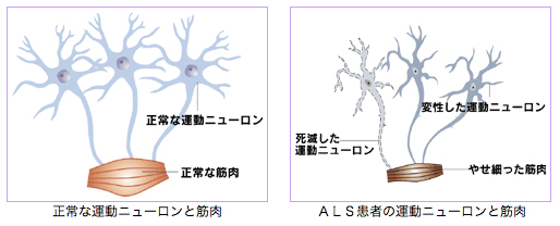 運動ニューロン